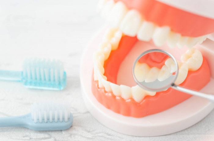 歯石とは？歯垢との違い何？