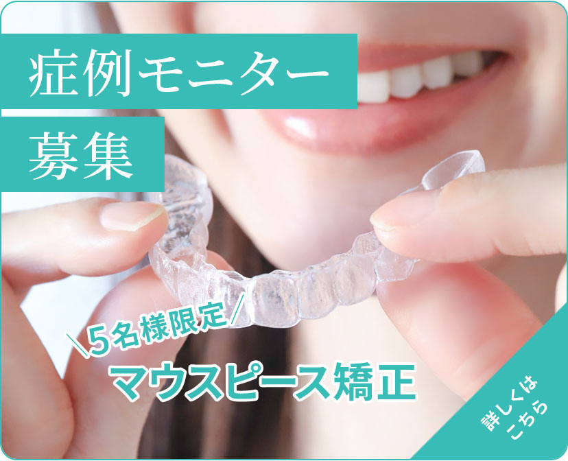 マウスピース矯正症例モニター募集　詳しくはこちら