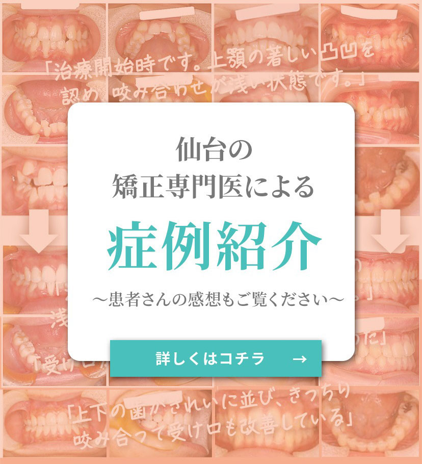 症例バナー