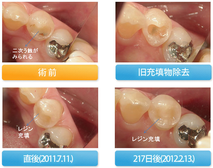 一般歯科 - 桂歯科クリニック
