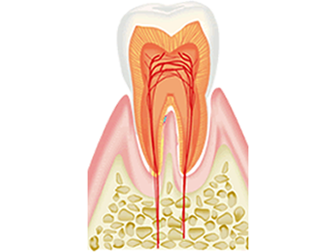 歯髄（神経）を残す重要性