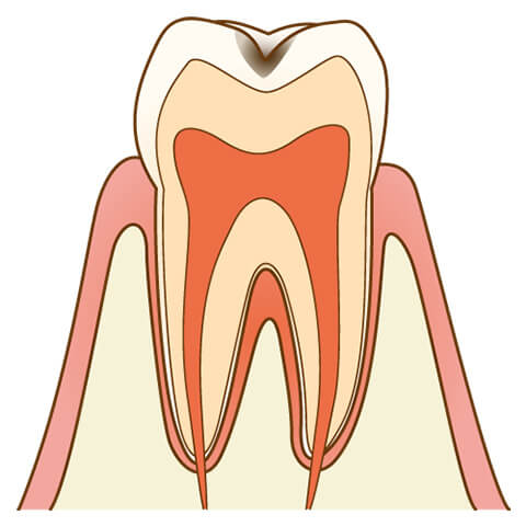 C1